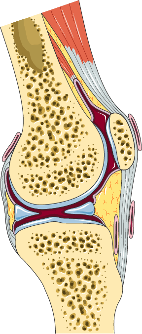Anatomical illustration of a section through the knee, showing the bone ends, the cartilage covering each joint surface and the narrow space between them