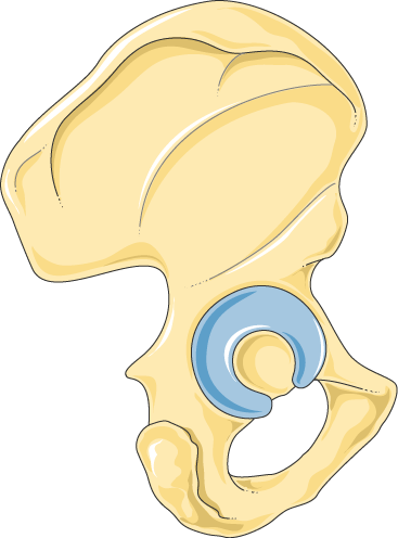 Anatomical illustration of a single hip bone, with the acetabulum, the cup shaped socket, at its centre